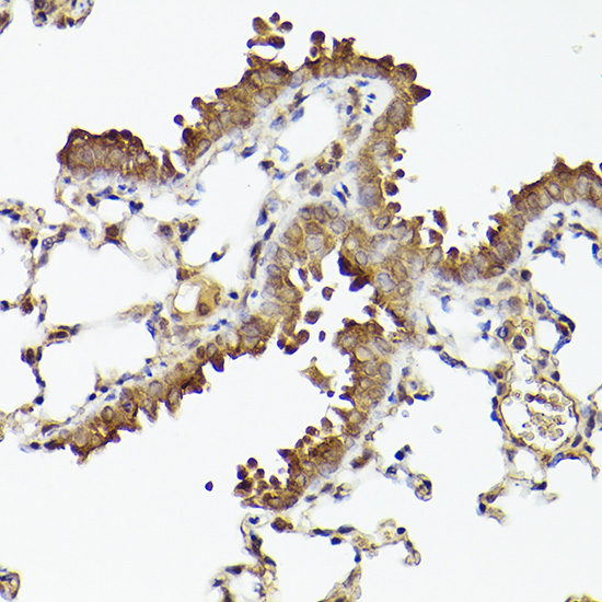 ATG12 Rabbit monoclonal antibody