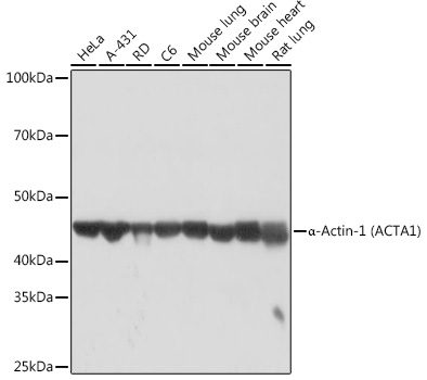 A Alpha-Actin-1 (ACTA1) Rabbit monoclonal antibody