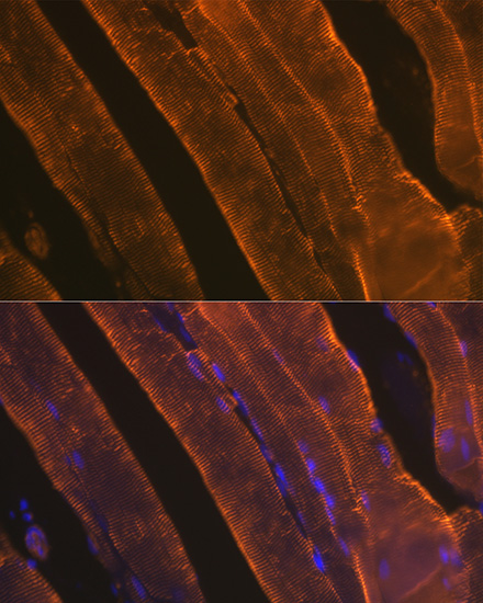 A Alpha-Actin-1 (ACTA1) Rabbit monoclonal antibody