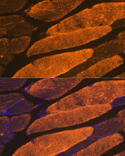 A Alpha-Actin-1 (ACTA1) Rabbit monoclonal antibody