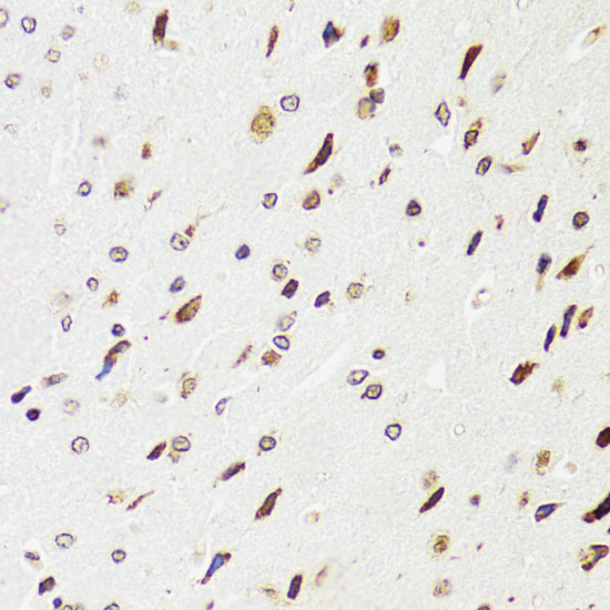 [KO Validated] EDF1 Rabbit polyclonal antibody