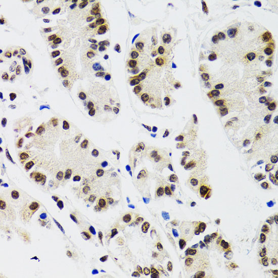 [KO Validated] EDF1 Rabbit polyclonal antibody