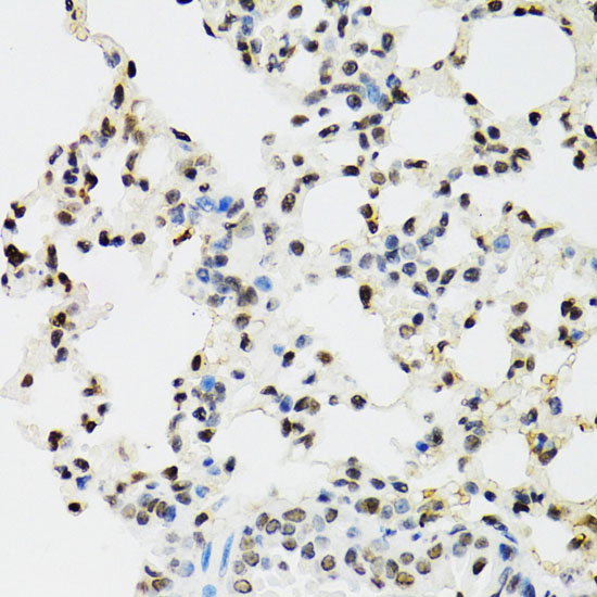 [KO Validated] EDF1 Rabbit polyclonal antibody