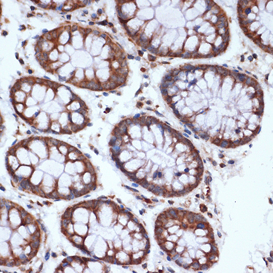 HSPA14 Rabbit monoclonal antibody