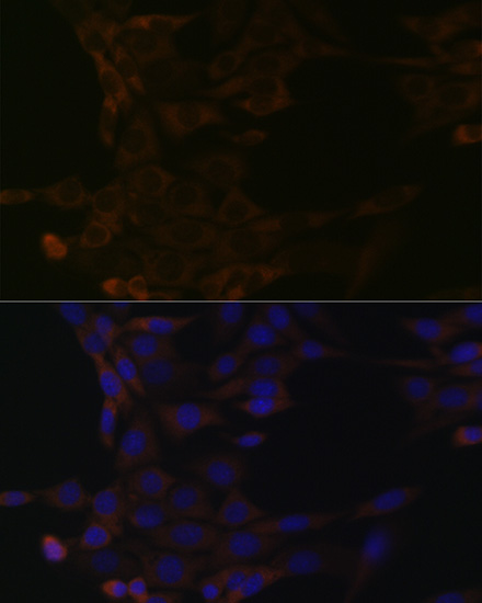 HSPA14 Rabbit monoclonal antibody