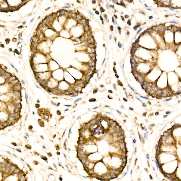 [KD Validated] COX IV Rabbit polyclonal antibody