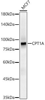 [KO Validated] CPT1A Rabbit monoclonal antibody