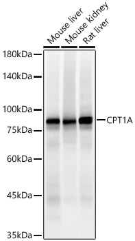 [KO Validated] CPT1A Rabbit monoclonal antibody