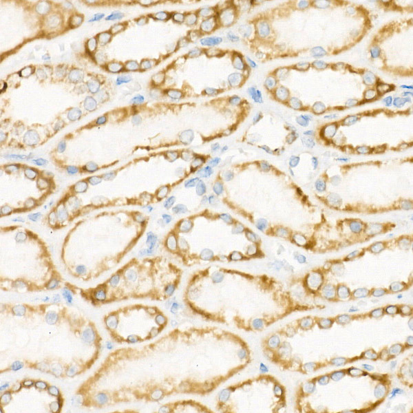 [KO Validated] CPT1A Rabbit monoclonal antibody