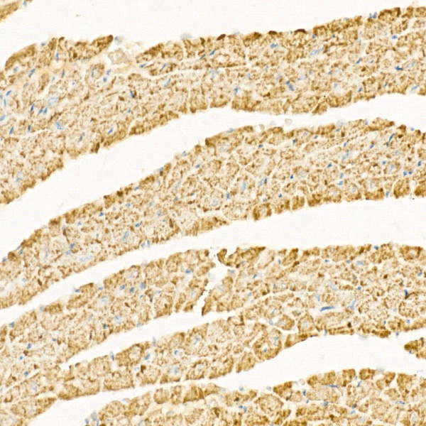[KO Validated] CPT1A Rabbit monoclonal antibody