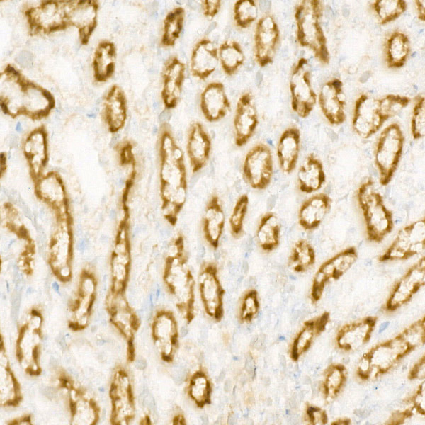 [KO Validated] CPT1A Rabbit monoclonal antibody