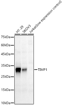 TIMP1 Rabbit monoclonal antibody