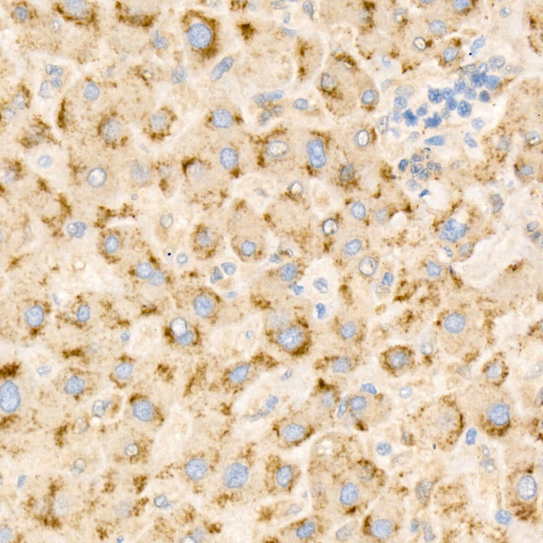TIMP1 Rabbit monoclonal antibody
