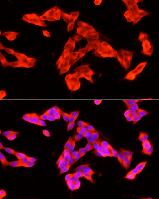 HTR3A Rabbit monoclonal antibody