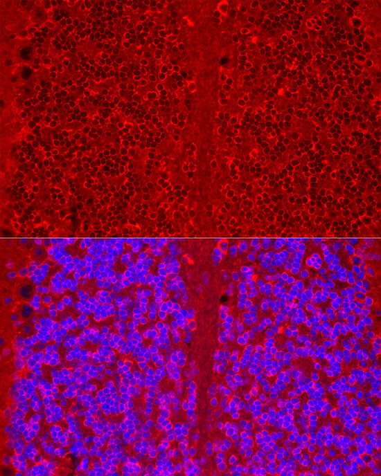 HTR3A Rabbit monoclonal antibody