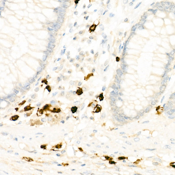 ALOX15 Rabbit monoclonal antibody