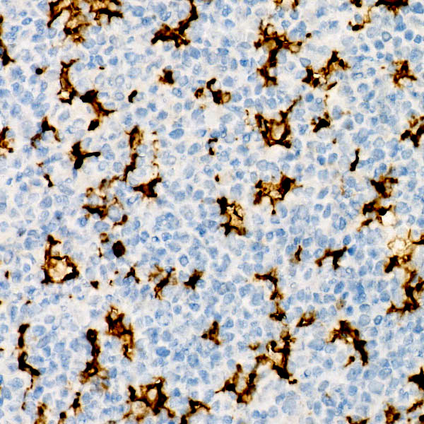 ITGAX Rabbit monoclonal antibody