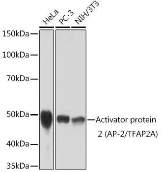 Activator protein 2 (AP-2/TFAP2A) Rabbit mAb