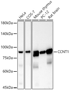 CCNT1 Rabbit monoclonal antibody