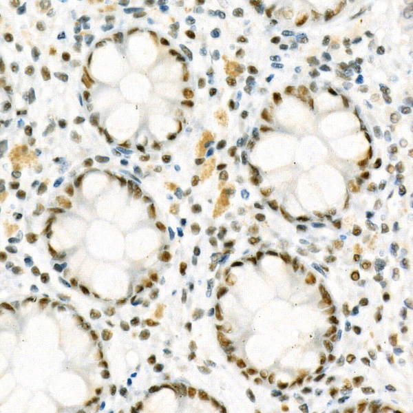 CCNT1 Rabbit monoclonal antibody