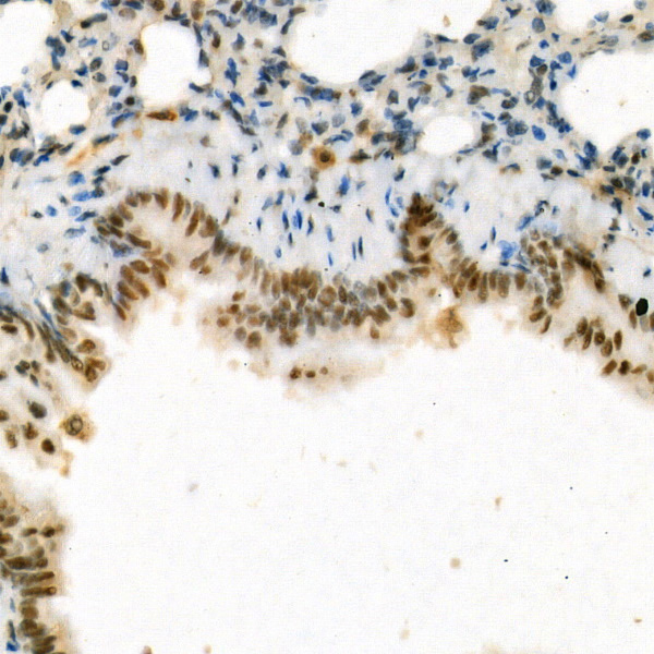 CCNT1 Rabbit monoclonal antibody