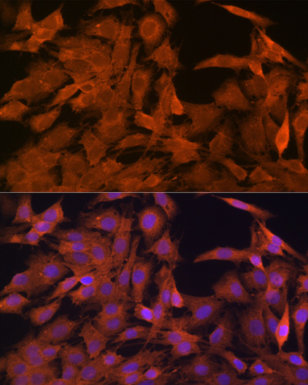 SRP54 Rabbit monoclonal antibody