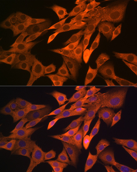 SRP54 Rabbit monoclonal antibody