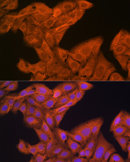 SRP54 Rabbit monoclonal antibody