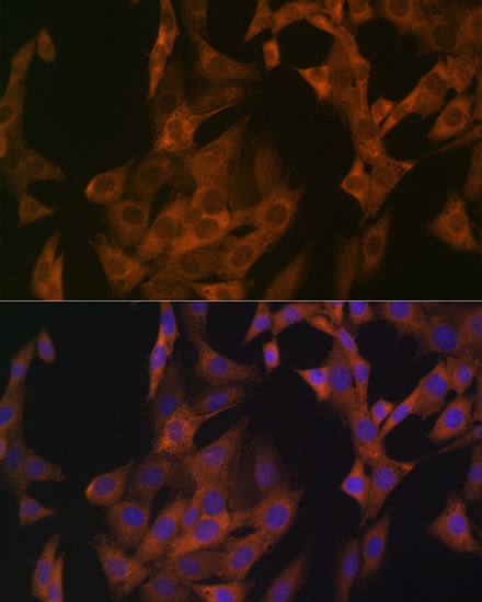 Zyxin Rabbit monoclonal antibody