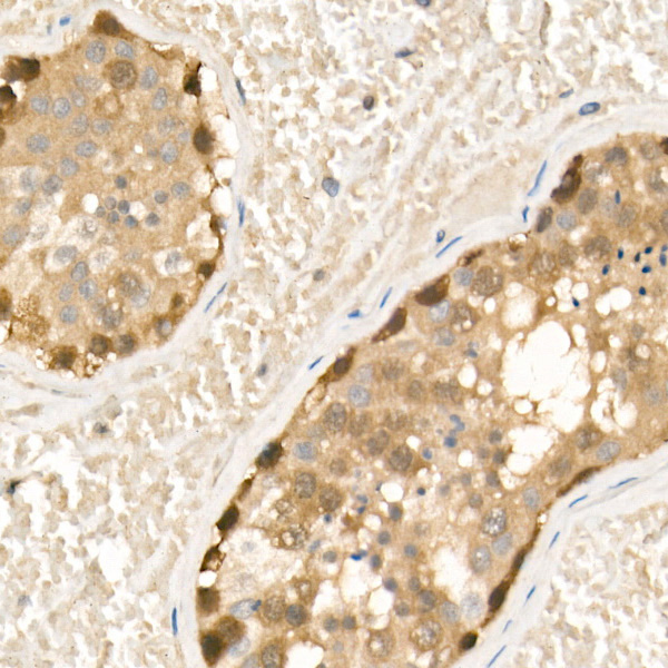 CBL Rabbit monoclonal antibody