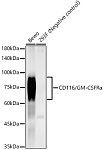 Western blot - CD116/GM-CSFRα Rabbit mAb (A23001)