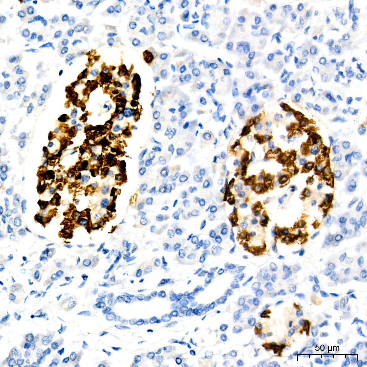 Glucagon Rabbit monoclonal antibody