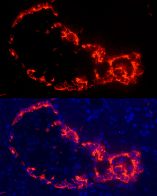 Glucagon Rabbit monoclonal antibody