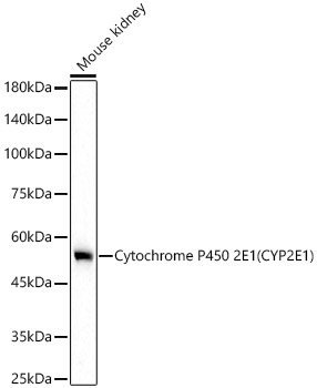Cytochrome P450 2E1 (CYP2E1) Rabbit mAb