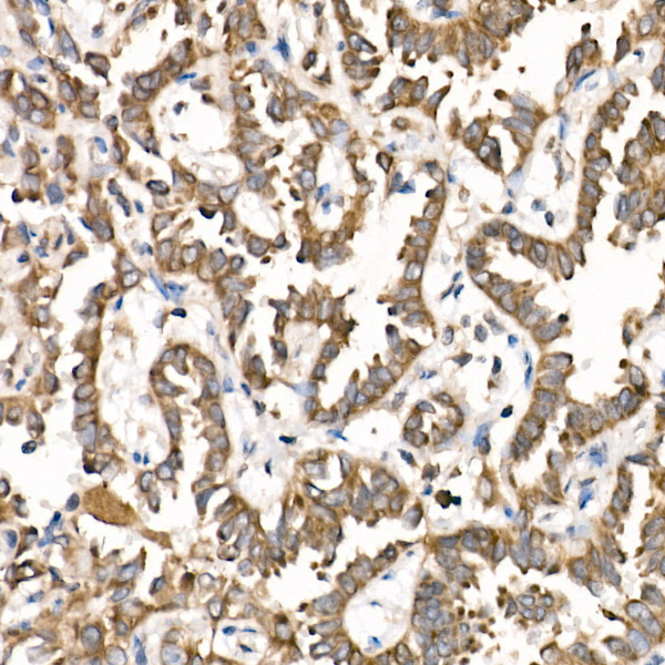 PTP1B Rabbit monoclonal antibody