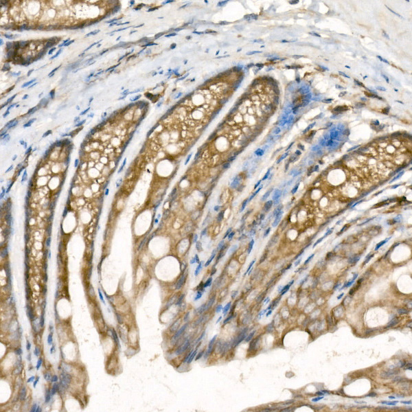 PTP1B Rabbit monoclonal antibody
