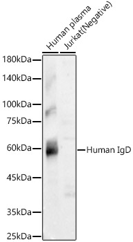 Human IgD Rabbit monoclonal antibody