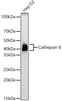 Cathepsin B Rabbit monoclonal antibody
