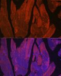 Immunofluorescence - CACNA1S Rabbit pAb (A23062)
