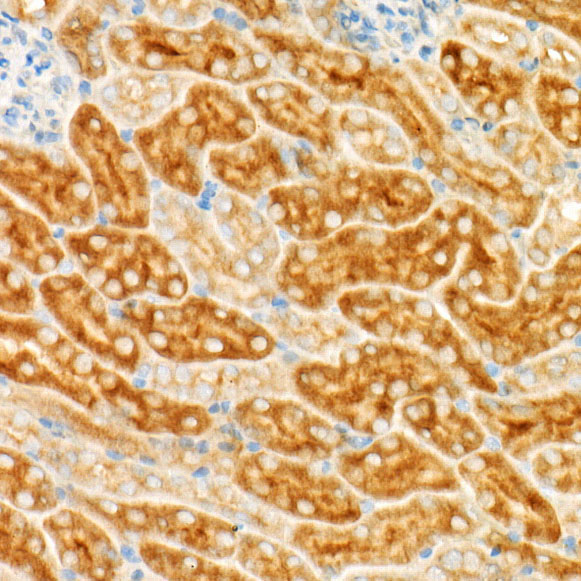 GCN2 Rabbit monoclonal antibody