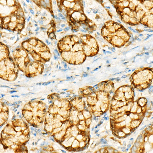 GCN2 Rabbit monoclonal antibody