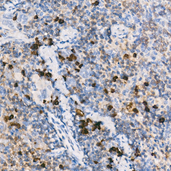 Mouse IgM Rabbit monoclonal antibody