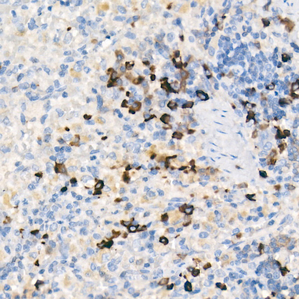 Mouse IgM Rabbit monoclonal antibody