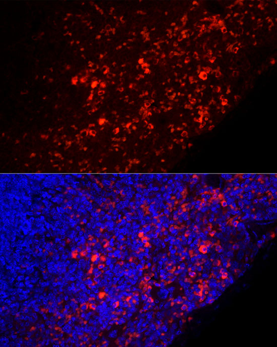 Mouse IgM Rabbit monoclonal antibody