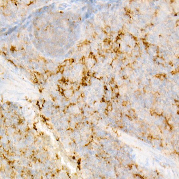 IL18 Rabbit monoclonal antibody
