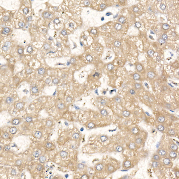 MGLL Rabbit monoclonal antibody