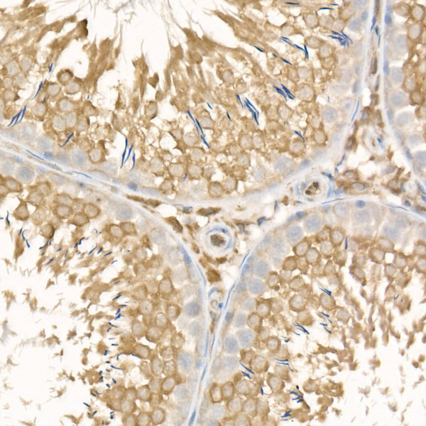 MGLL Rabbit monoclonal antibody