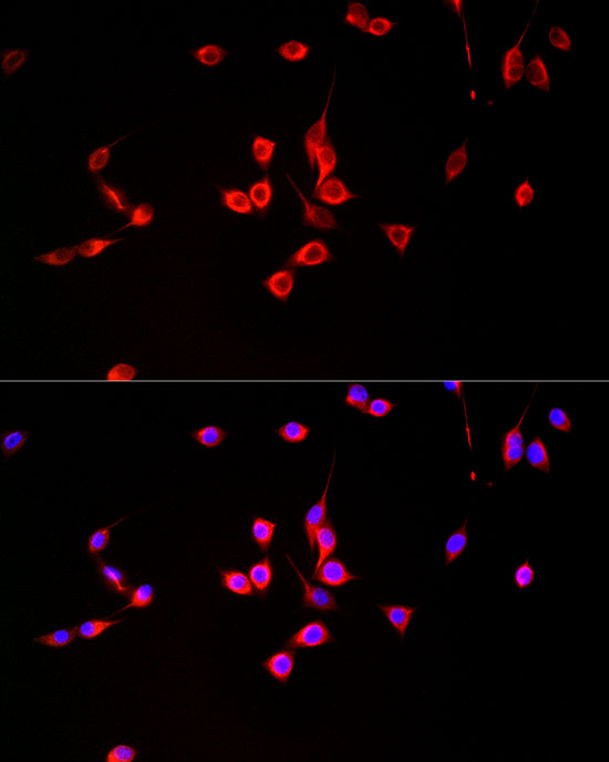 MGLL Rabbit monoclonal antibody