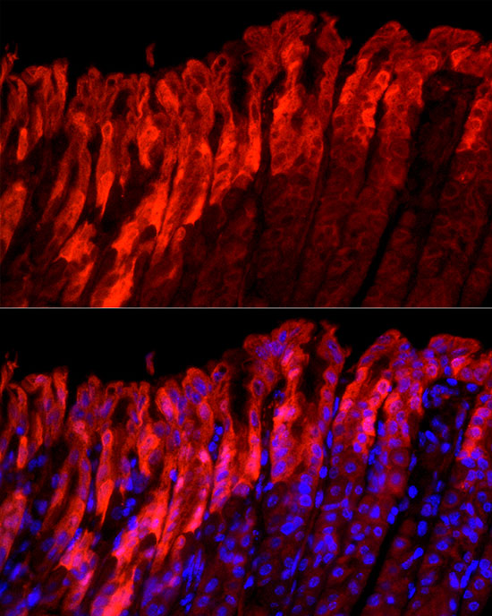 ALDH3A1 Rabbit monoclonal antibody