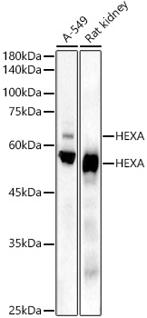 HEXA Rabbit monoclonal antibody